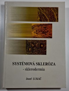 Systémová skleróza - sklerodermia ( slovensky )
