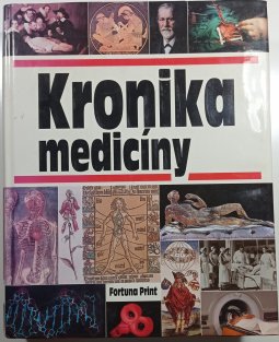 Kronika medicíny