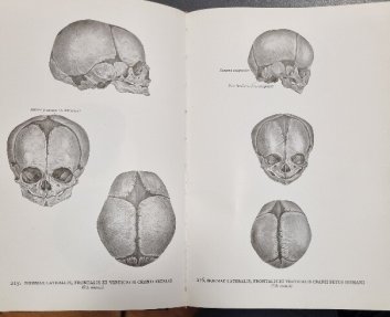 Atlas of Human Anatomy