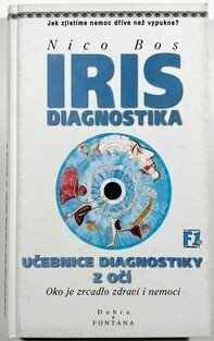 Irisdiagnostika