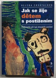 Jak se žije dětem s postižením - 