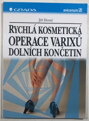 Rychlá kosmetická operace Varixů dolních končetin - 