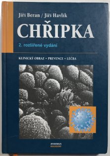 Chřipka - klinický obraz, prevence a léčba