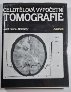 Celotělová výpočetní tomografie