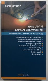 Ambulantní operace křečových žil