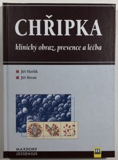 Chřipka - klinický obraz, prevence a léčba