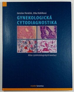 Gynekologická cytodiagnostika