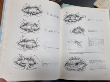 Chirurgische Operationen - Ein Atlas für die Praxis I.+II.