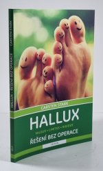 Hallux - Řešení bez operace - valgus, limitus, rigidus