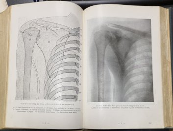 Anatomischer atlas I. für studierende und ärzte
