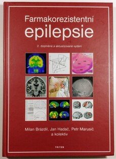Farmakorezistentní epilepsie (2. doplněné vydání)