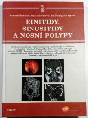 Rinitidy, sinusitidy a nosní polypy - 